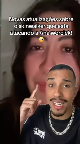 ana.whiterose reddit | Discover